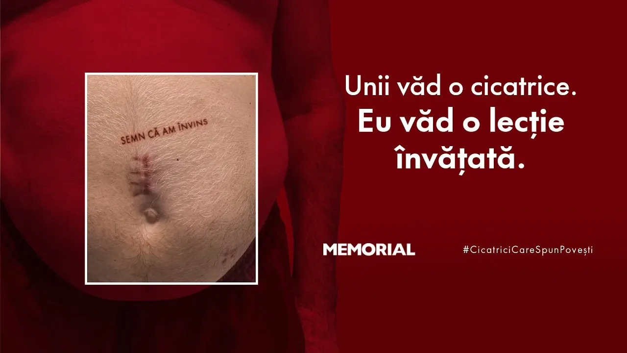 Cicatrici_care_spun_povești_testul_suprem_al_cancerului_de_prostată.webp